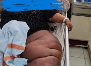 Ringankan Beban Mustahik: BAZNAS Sidoarjo Serahkan Bantuan Pengobatan Ibu Rachmaliyah Melalui Sang Adik