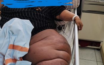 Ringankan Beban Mustahik: BAZNAS Sidoarjo Serahkan Bantuan Pengobatan Ibu Rachmaliyah Melalui Sang Adik