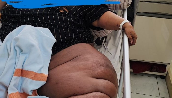 Ringankan Beban Mustahik: BAZNAS Sidoarjo Serahkan Bantuan Pengobatan Ibu Rachmaliyah Melalui Sang Adik